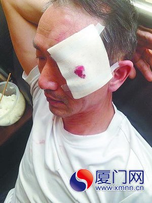 被打护工