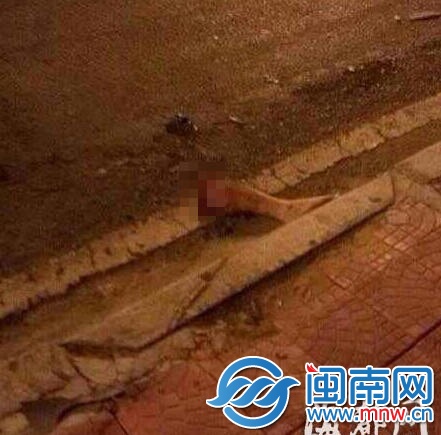 被撞断的小腿